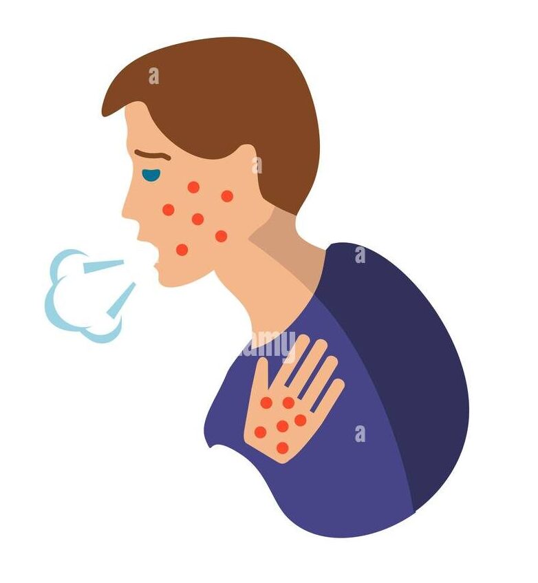 allergy icon simple element from health diseases collection creative allergy icon for web design templates infographics and more 2dc2ej5 e1747829893242