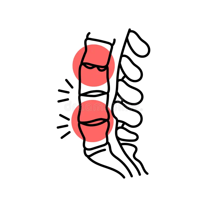 ankylosing spondylitis color line icon diseases spine ankylosing spondylitis color line icon diseases spine 349547084