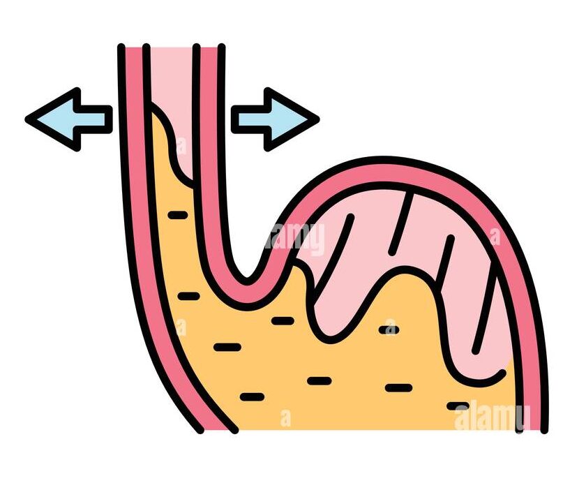 gerd olor line icon gastroesophageal reflux disease pictogram for web page mobile app promo ui ux gui design element editable stroke 2f9e98d e1747899821856