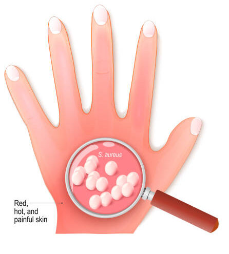 istockphoto 1413222957 612x612 1 e1747832244130