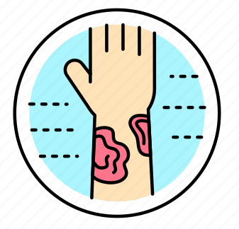 layer skin disease lichen planus 512 e1747900527917