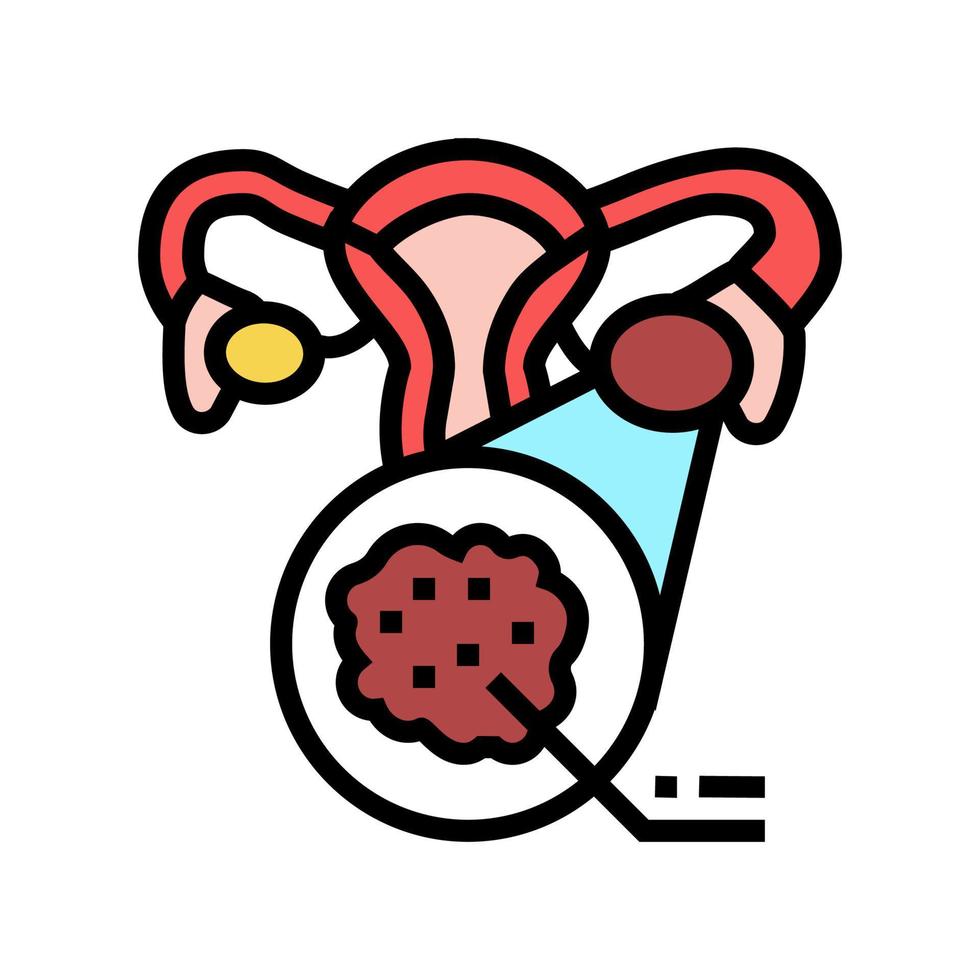 polycystic ovary syndrome endocrinology color icon illustration vector